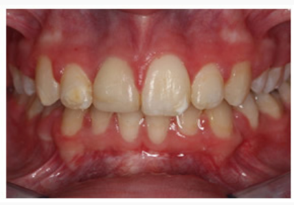 Case 2 Before
