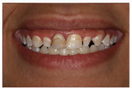 Case 1 Before
